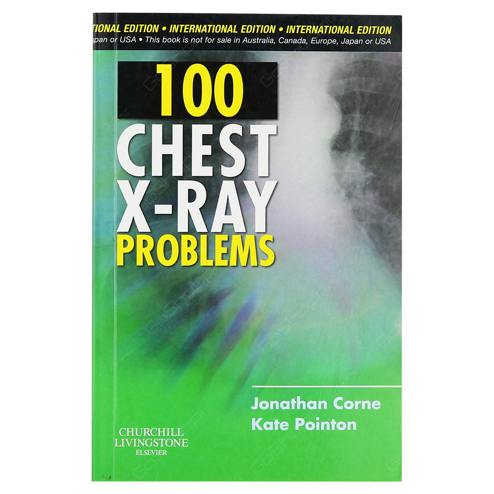100 Chest X-Ray Problems International Edition