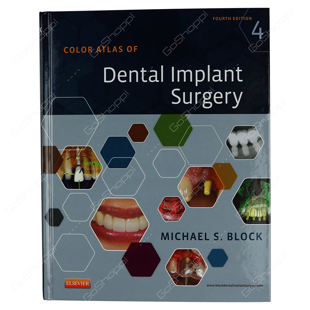 Color Atlas Of Dental Implant Surgery By Michael S. Block