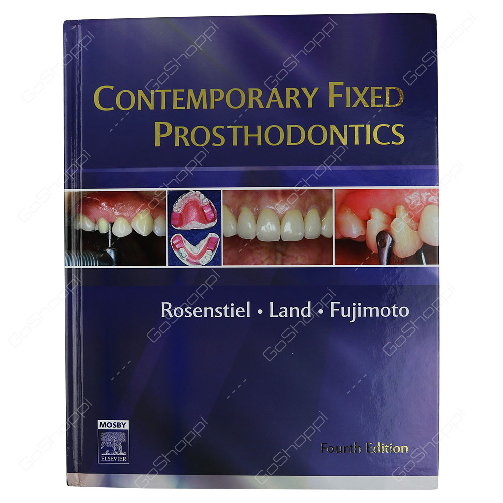Contemporary Fixed Prosthodontics By Stephen F. Rosenstiel