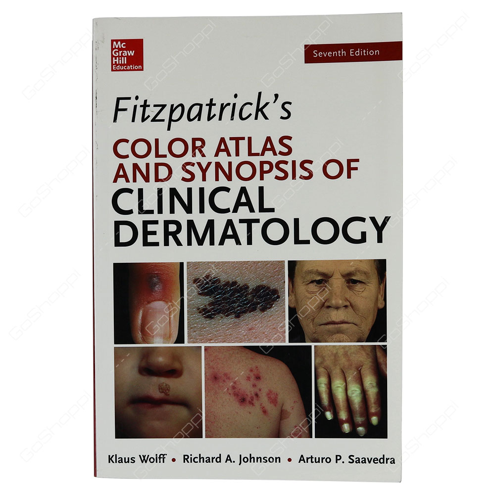 Fitzpatrick