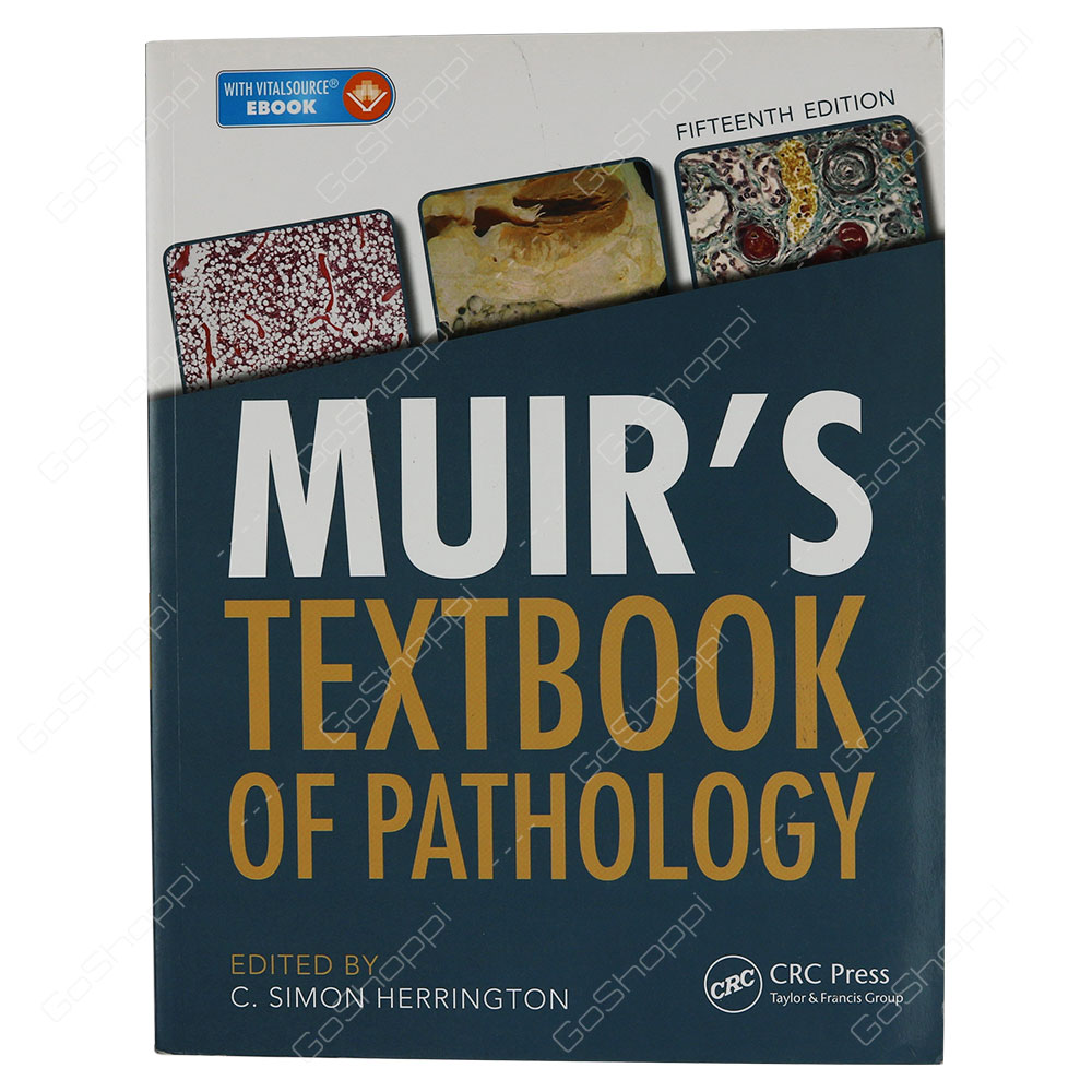 Muir